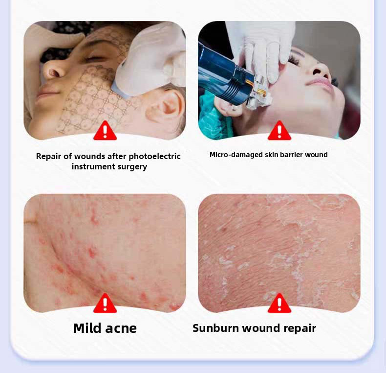 Facial chitosan wound dressing. Hydrating and moisturizing mask to prevent skin aging