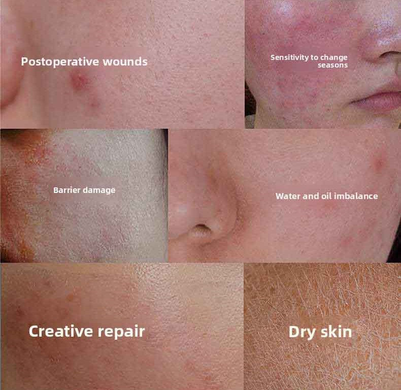 Sterile barrier repair medical skin care abrasion/tear repair dressing, postoperative wound healing and repair