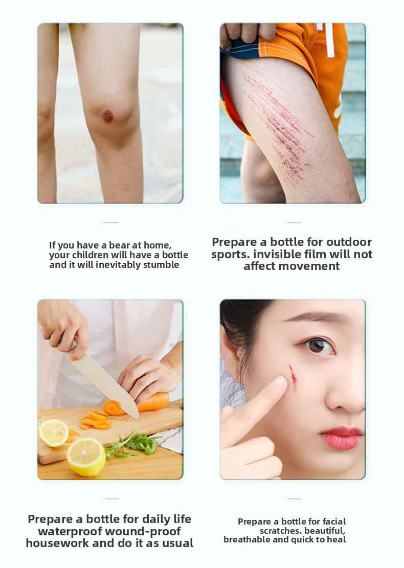Skin-friendly sterile spray wound dressing for cuts, scrapes, lacerations, and burns. 30-second curing film, waterproof and quick-drying, for medical wound dressings for home use.