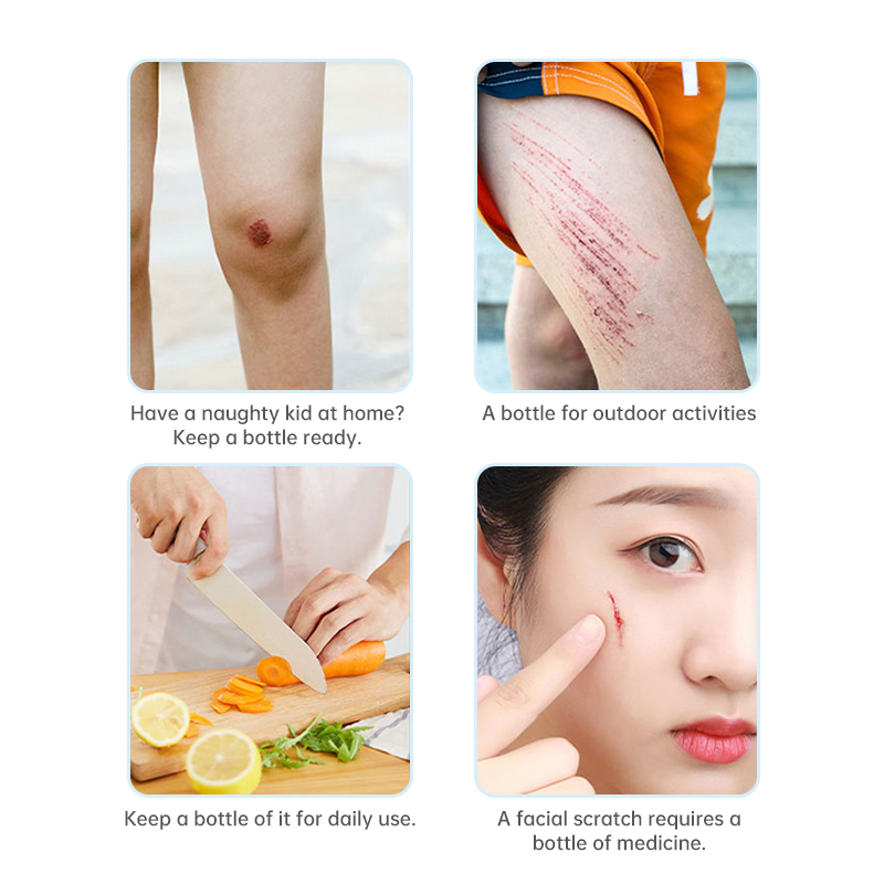 Skin-friendly sterile spray wound dressing for cuts, scrapes, lacerations, and burns. 30-second curing film, waterproof and quick-drying, for medical wound dressings for home use.