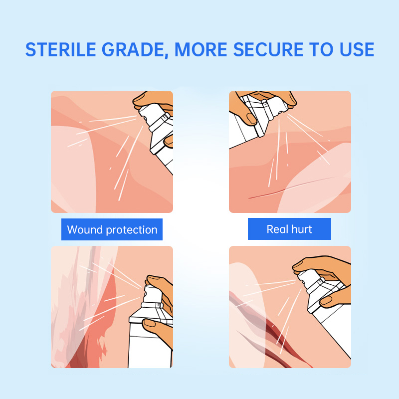 Skin-friendly sterile spray wound dressing for cuts, scrapes, lacerations, and burns. 30-second curing film, waterproof and quick-drying, for medical wound dressings for home use.