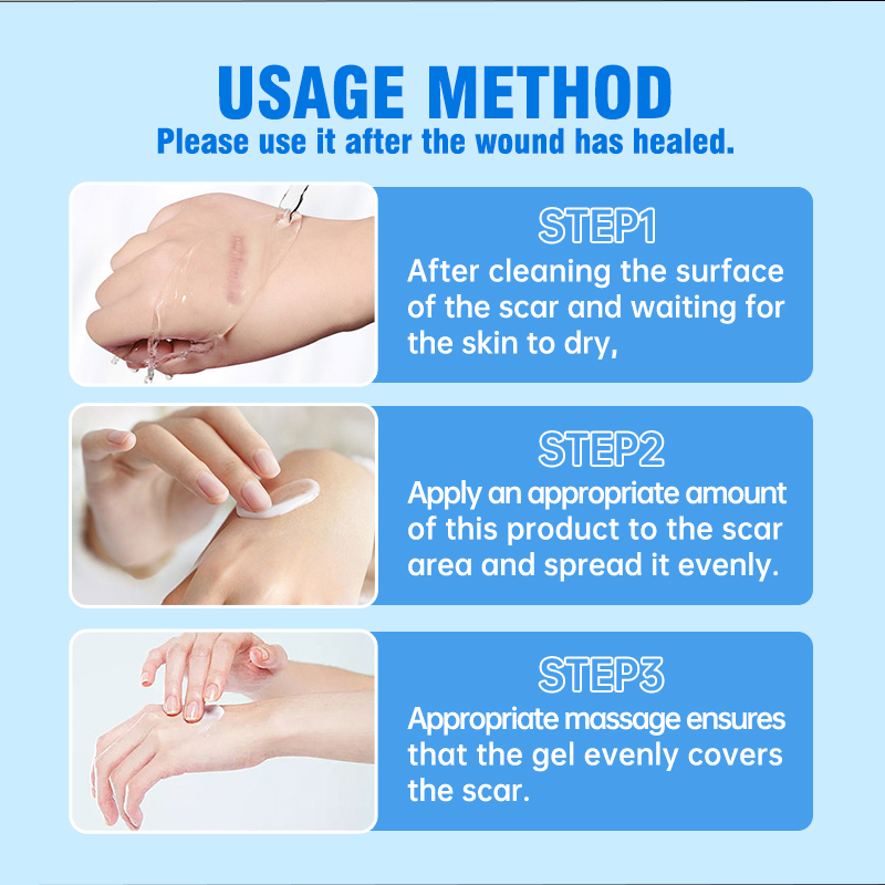 This medical-grade scar repair cream can repair acne scars, atrophic scars, stretch marks, pigmentation scars, surgical scars, burn scars, and more. Suitable for all skin types!