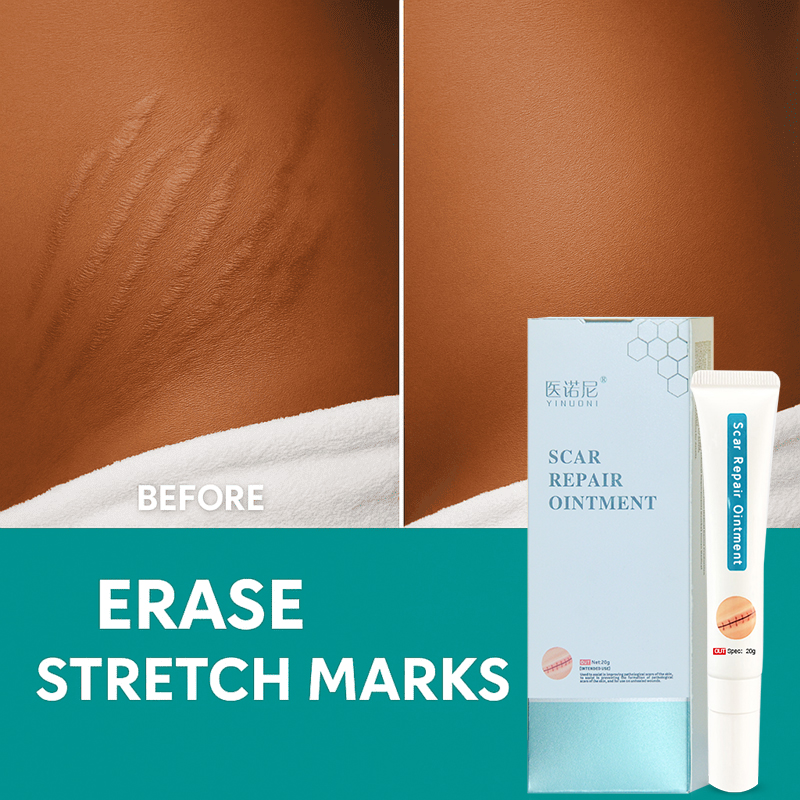 This medical-grade scar repair cream can repair acne scars, atrophic scars, stretch marks, pigmentation scars, surgical scars, burn scars, and more. Suitable for all skin types!
