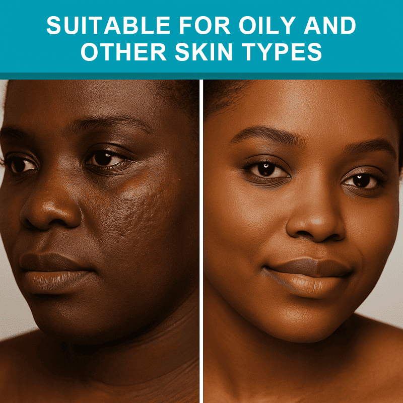 This medical-grade scar repair cream can repair acne scars, atrophic scars, stretch marks, pigmentation scars, surgical scars, burn scars, and more. Suitable for all skin types!