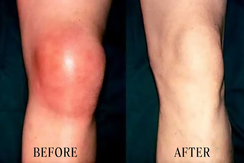 Medical-grade pain relief patch. Promotes local blood circulation, helps reduce inflammation, swelling, and pain. Skin-friendly and breathable!