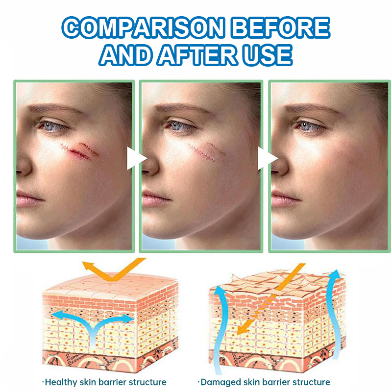 Sterile medical skin care dressings for abrasions/tears, postoperative wound healing and repair (5 dressings/box)