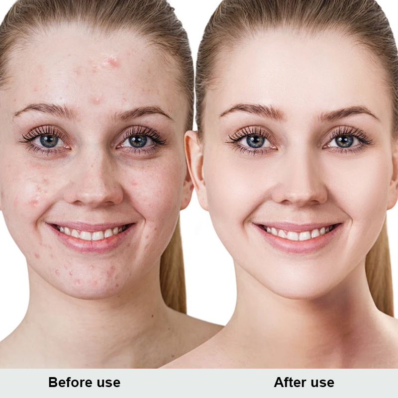 Sterile medical skin care dressings for abrasions/tears, postoperative wound healing and repair (5 dressings/box)