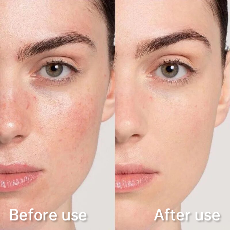 Facial chitosan wound dressing. Hydrating and moisturizing mask to prevent skin aging (5 pieces/box)