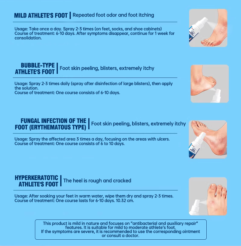 Renhe Medical Chitosan Athlete's Foot Spray. Relieves peeling, blisters, itching, sweaty feet, and fungal infections. Suitable for both men and women.