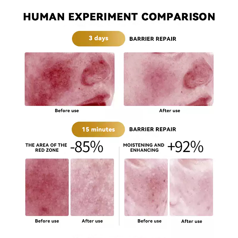 Medical Recombinant Collagen Repair Patch