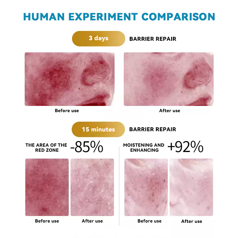 Medical Sodium Hyaluronate Repair Patch