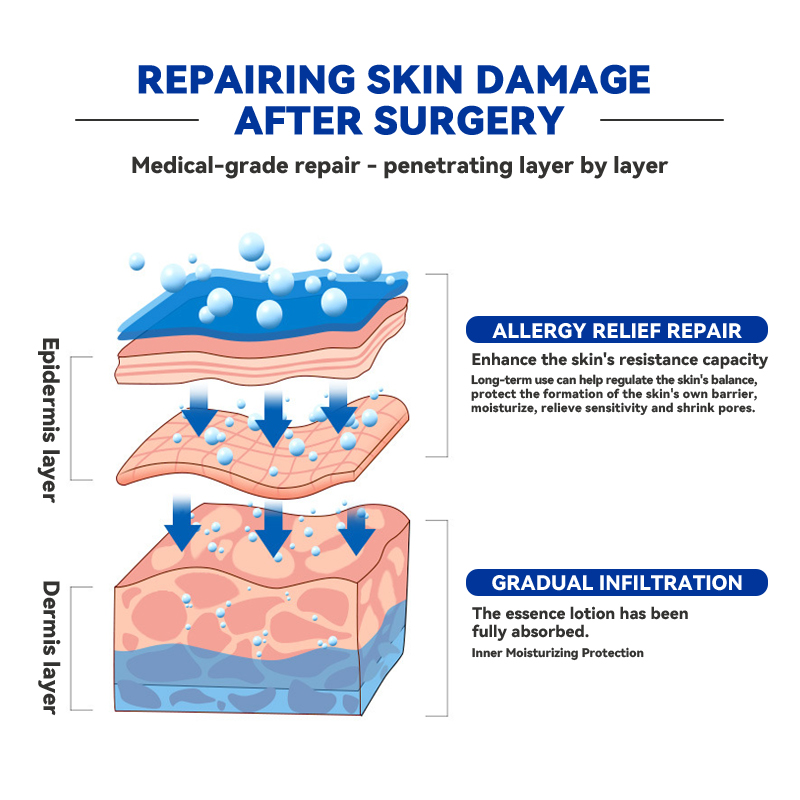 Medical Grade Sterile Chitosan Facial Mask