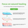 Skin-friendly sterile spray wound dressing for cuts, scrapes, lacerations, and burns. 30-second curing film, waterproof and quick-drying, for medical wound dressings for home use.