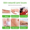Skin-friendly sterile spray wound dressing for cuts, scrapes, lacerations, and burns. 30-second curing film, waterproof and quick-drying, for medical wound dressings for home use.