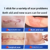 Medical scar repair cream, can repair acne marks/depressed scars/stretch marks/pigmentation scars/surgical scars/burn scars, etc. Hypoallergenic and moisturizing repair!