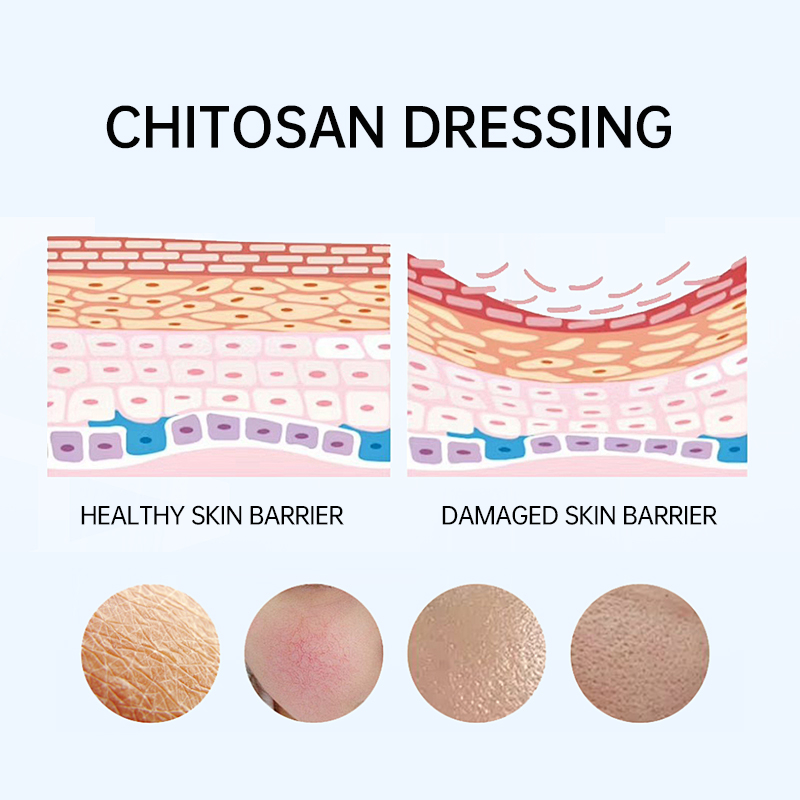 Facial chitosan wound dressing. Hydrating and moisturizing mask to prevent skin aging (5 pieces/box)