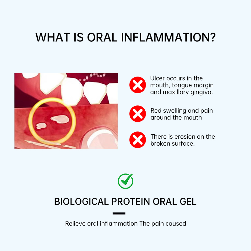 Bioprotein oral gel, applicable to: oral ulcers/inflammation, bleeding gums, relief of surgical wound pain, safe medical grade!