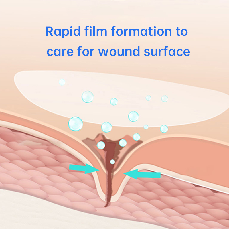 Skin-friendly sterile spray wound dressing for cuts, scrapes, lacerations, and burns. 30-second curing film, waterproof and quick-drying, for medical wound dressings for home use.