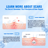 This medical-grade scar repair cream can repair acne scars, atrophic scars, stretch marks, pigmentation scars, surgical scars, burn scars, and more. Suitable for all skin types!