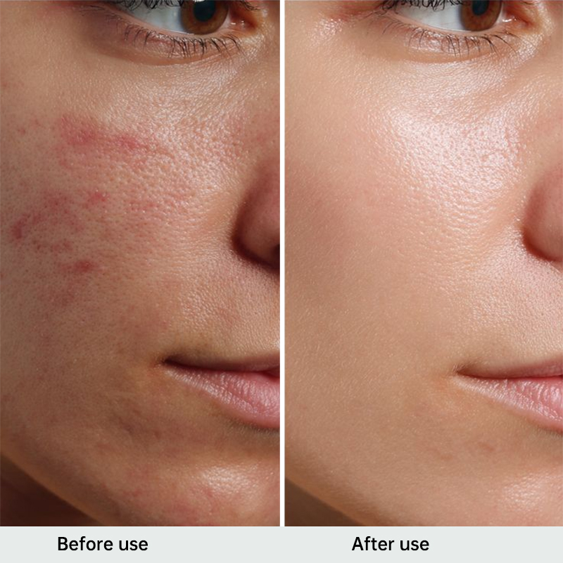 Sterile medical skin care dressings for abrasions/tears, postoperative wound healing and repair (5 dressings/box)