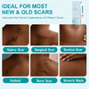 This medical-grade scar repair cream can repair acne scars, atrophic scars, stretch marks, pigmentation scars, surgical scars, burn scars, and more. Suitable for all skin types!