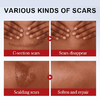 This medical-grade scar repair cream can repair acne scars, atrophic scars, stretch marks, pigmentation scars, surgical scars, burn scars, and more. Suitable for all skin types!
