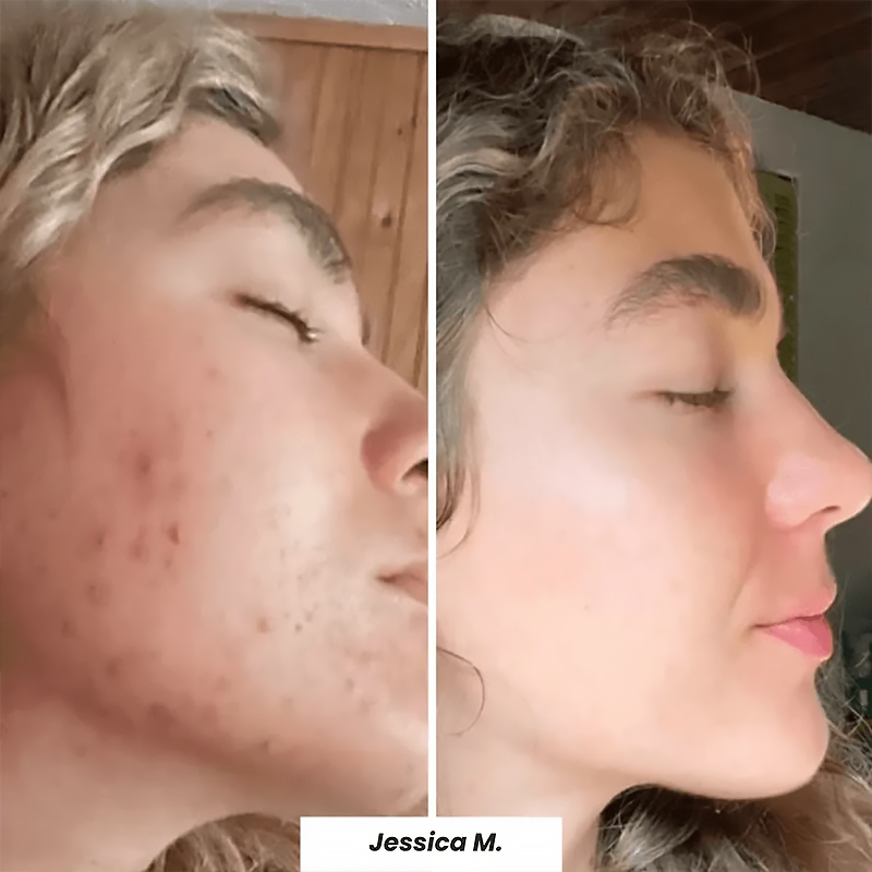 Sterile medical skin care dressings for abrasions/tears, postoperative wound healing and repair (5 dressings/box)