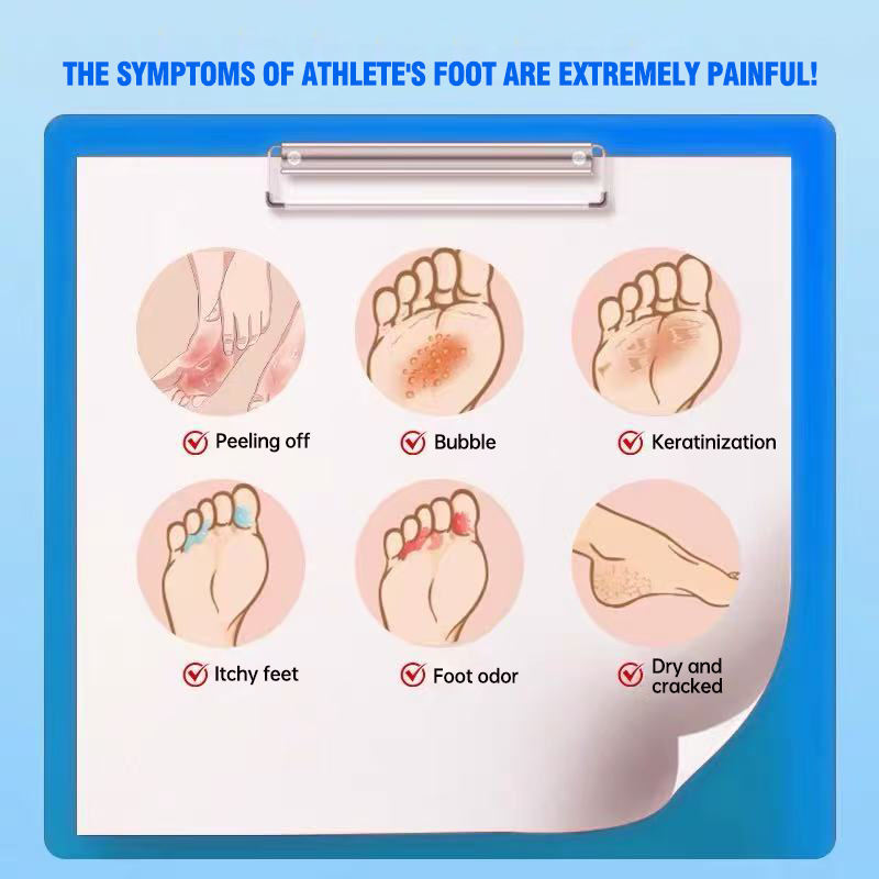 Renhe Medical Chitosan Athlete's Foot Spray. Relieves peeling, blisters, itching, sweaty feet, and fungal infections. Suitable for both men and women.